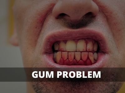 gum problem