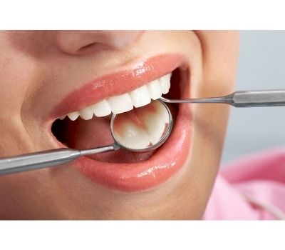 how to dental filling is done