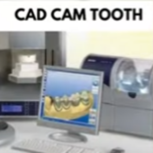 Cad Cam