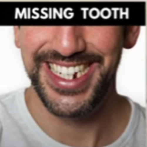 Missing Tooth