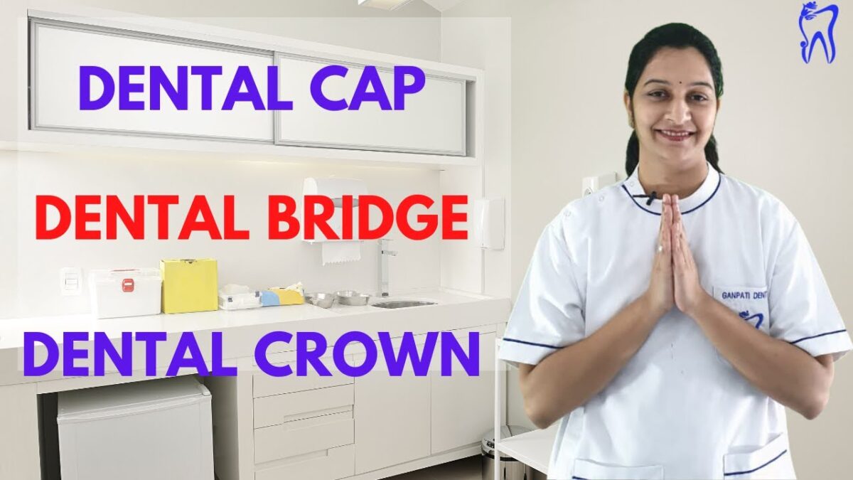 Dental Cap Dental Crown Types