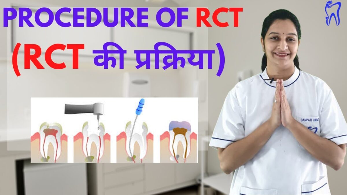 Painless Root Canal Treatment 5 Easy Steps of RCT infographic showing root canal procedure step by step