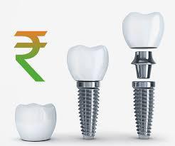 dental implant price in india