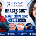 Braces Cost at Ganpati Dental Clinic in 2026 featuring metal braces, ceramic braces and clear aligners