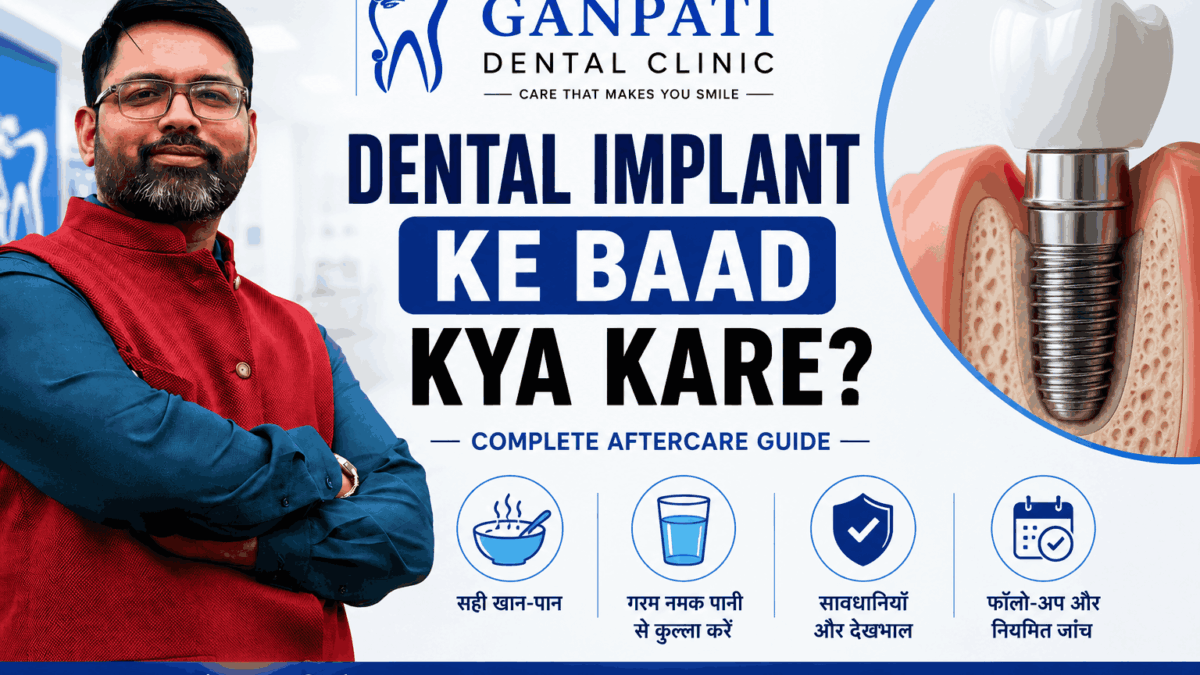 Dental Implant Ke Baad Kya Kare Complete Aftercare Guide by Ganpati Dental Clinic