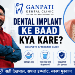Dental Implant Ke Baad Kya Kare Complete Aftercare Guide by Ganpati Dental Clinic