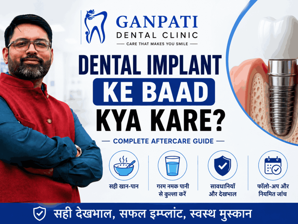 Dental Implant Ke Baad Kya Kare Complete Aftercare Guide by Ganpati Dental Clinic