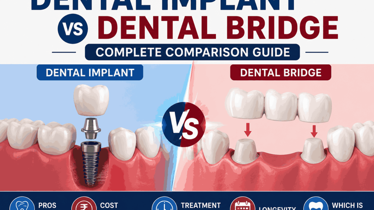 Dental Implant vs Bridge Complete Comparison Guide
