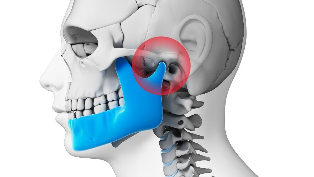 tmj joint(temporal-mandibular joint)