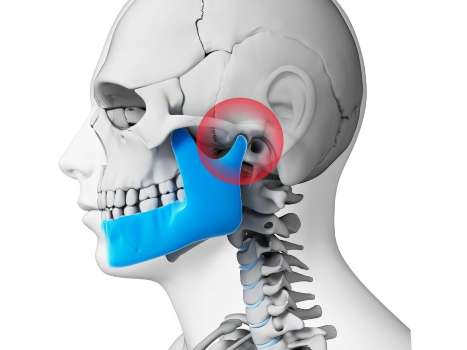 tmj joint(temporal-mandibular joint)