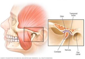 Tmj treatment