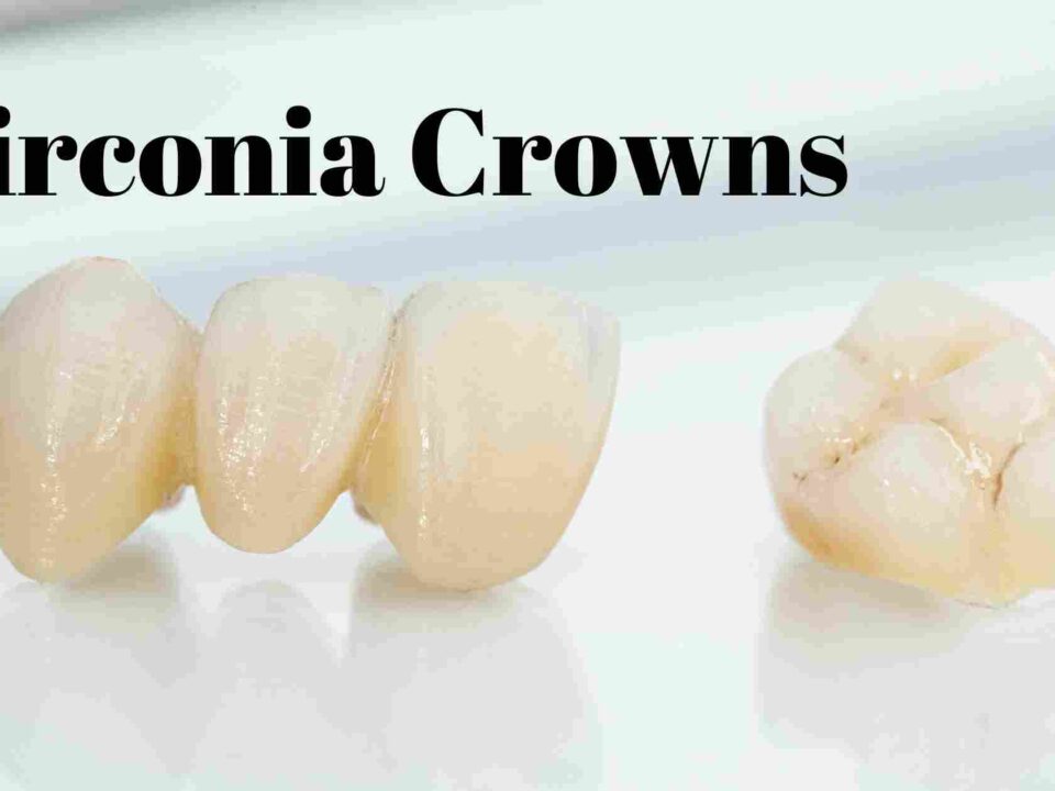 zirconia crowns